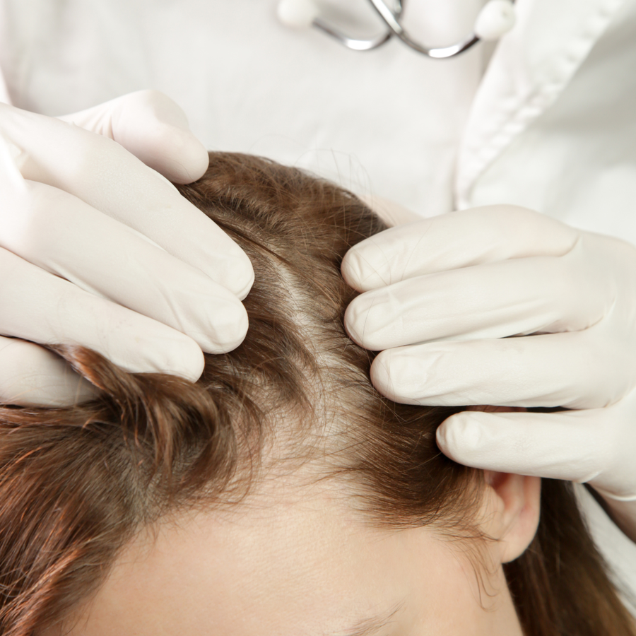 SR concern 1: thinning hair